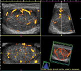 uriner-sistem-ve-urogenital-ultrason.png